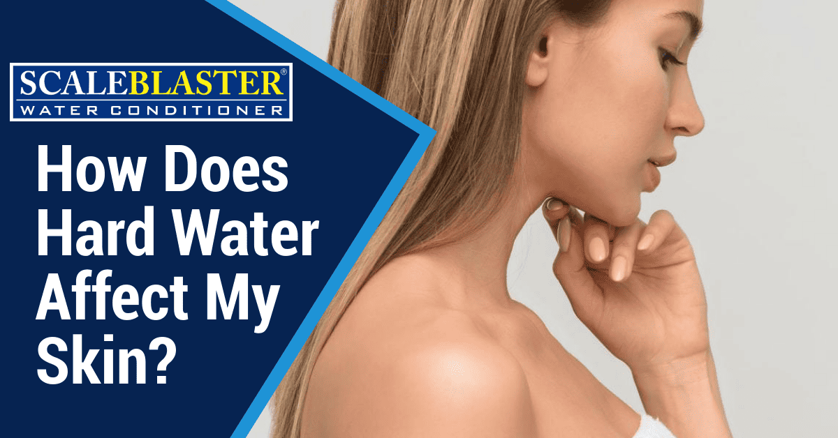 How Does Hard Water Affect My Skin - How Does Hard Water Affect My Skin?